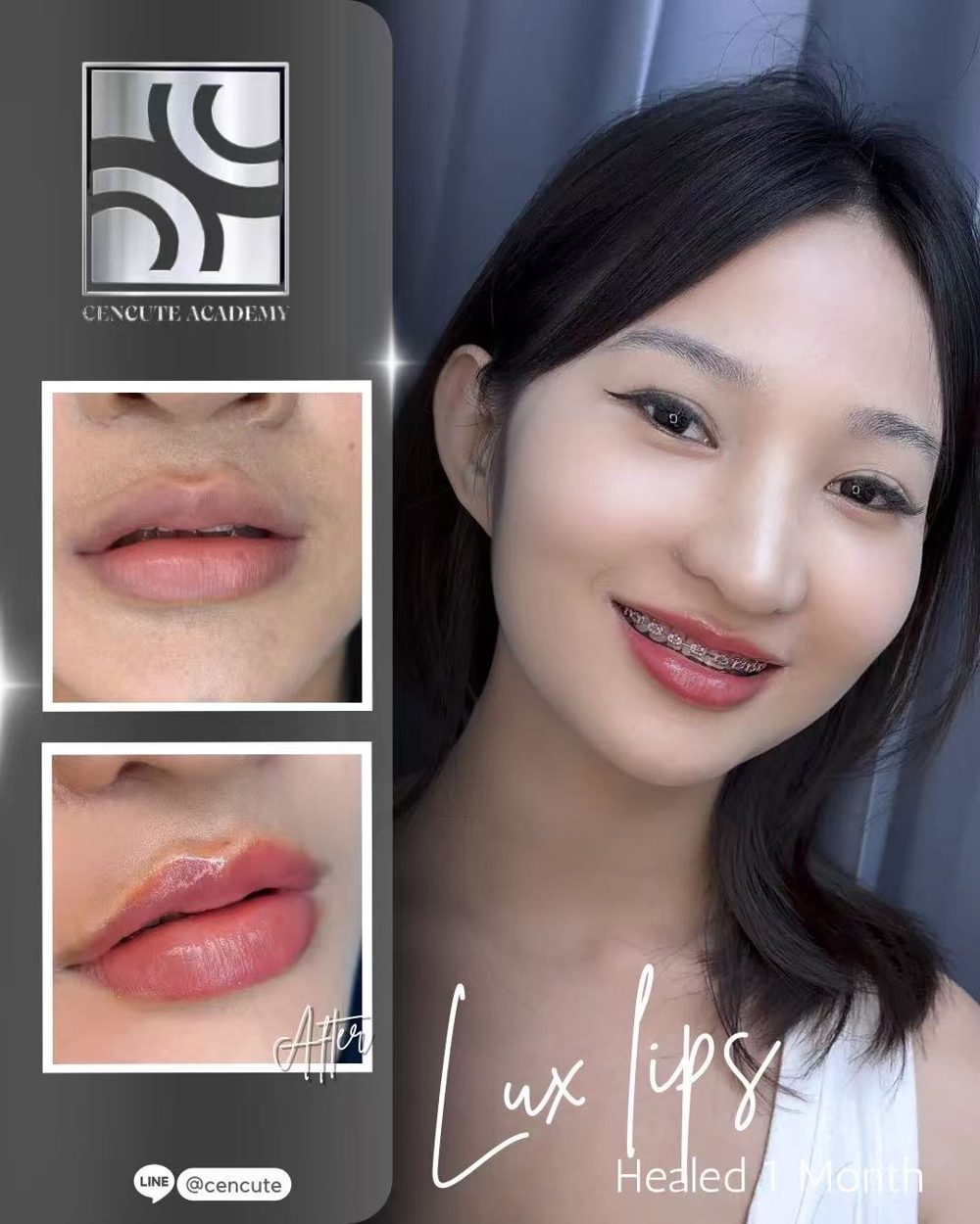 ผลงานสักปาก baby lips สีชมพูธรรมชาติ · Cencute Studio